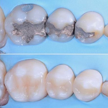 Terapia Conservativa