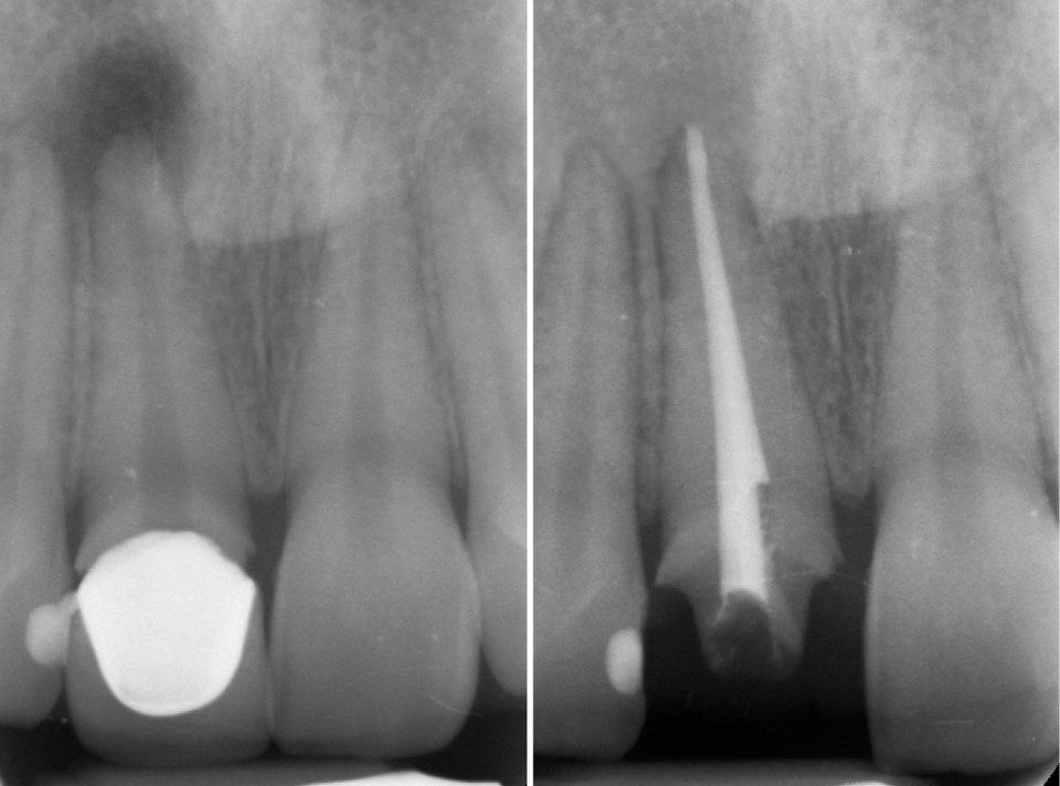Endodonzia