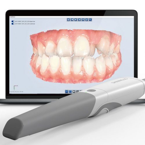 Scanner Intraorale